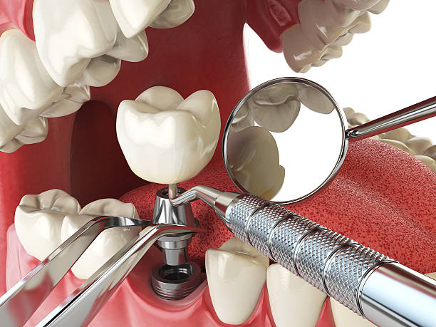 Best Emergency Treatment for Jaw Pain or Injury in Cade, LA