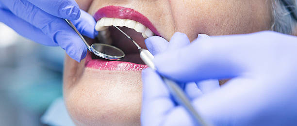 Professional Emergency Dental Service in LA